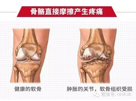 健身教练营养餐_健身教练需要吃哪些补剂_健身教练怎么补充营养